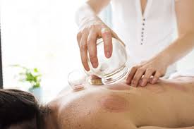 Cupping